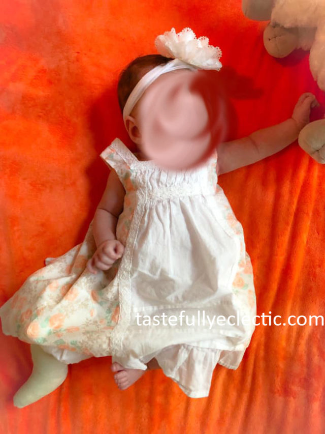 Babies with Clubfoot A Practical Guide for Parents Tastefully Eclectic