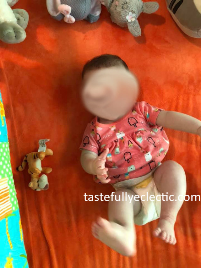 Babies with Clubfoot A Practical Guide for Parents Tastefully Eclectic