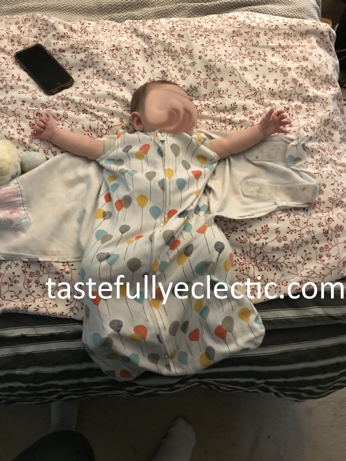 Babies with Clubfoot A Practical Guide for Parents Tastefully Eclectic